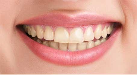 Smile Zone Dental Clinic